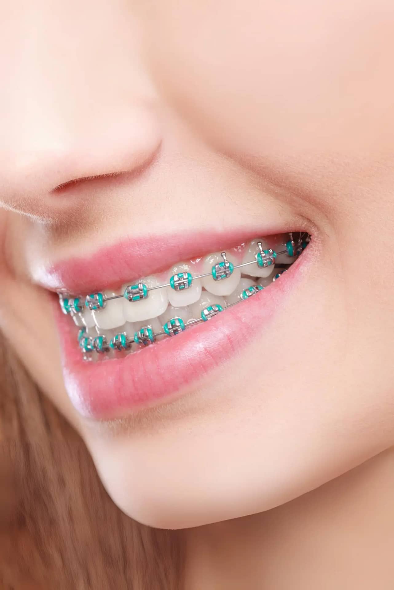 Teeth Bridges Treatments in Kakkanad